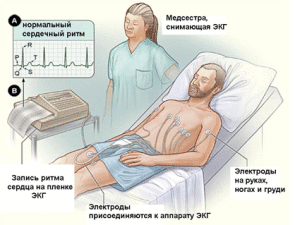 Электрокардиография (ЭКГ)